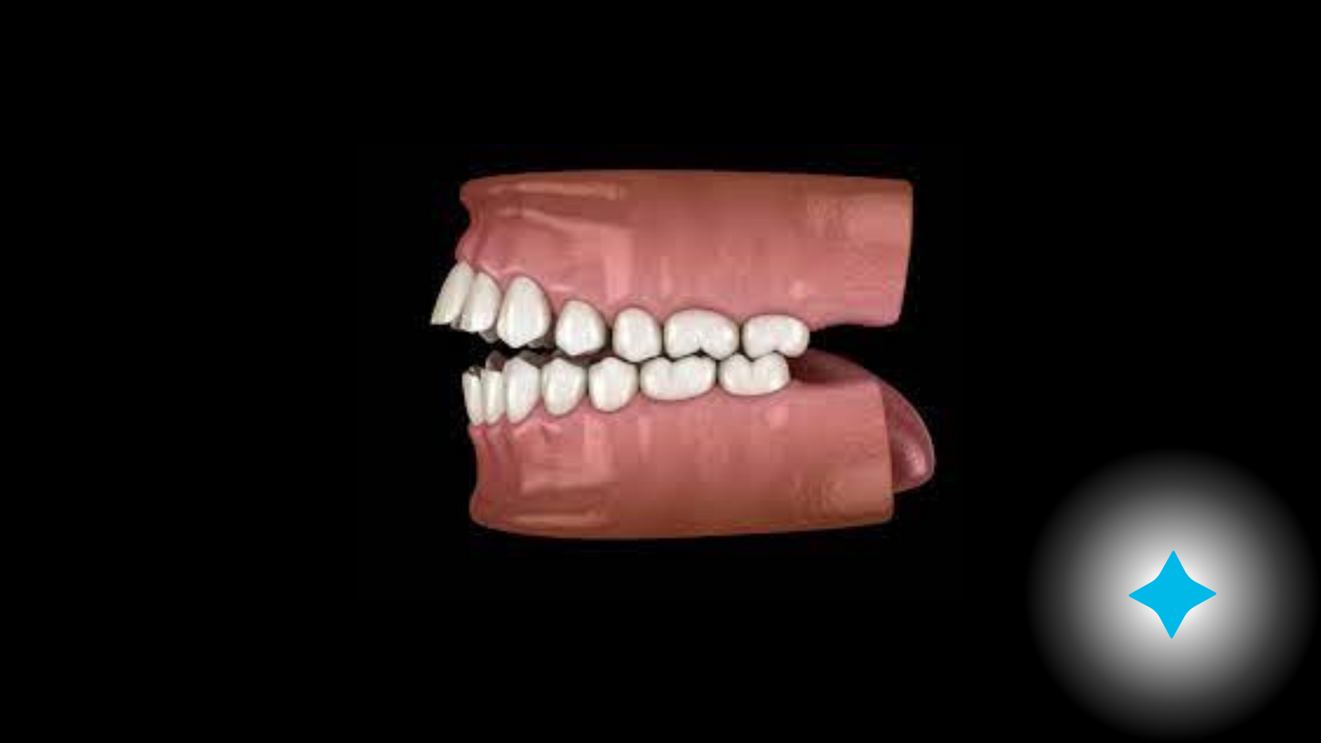 A close up of a model of a person 's teeth on a black background.