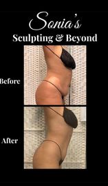 Before-and-after side profile photos of a woman’s torso and buttocks, with “Sonia’s Sculpting & Beyond” branding.