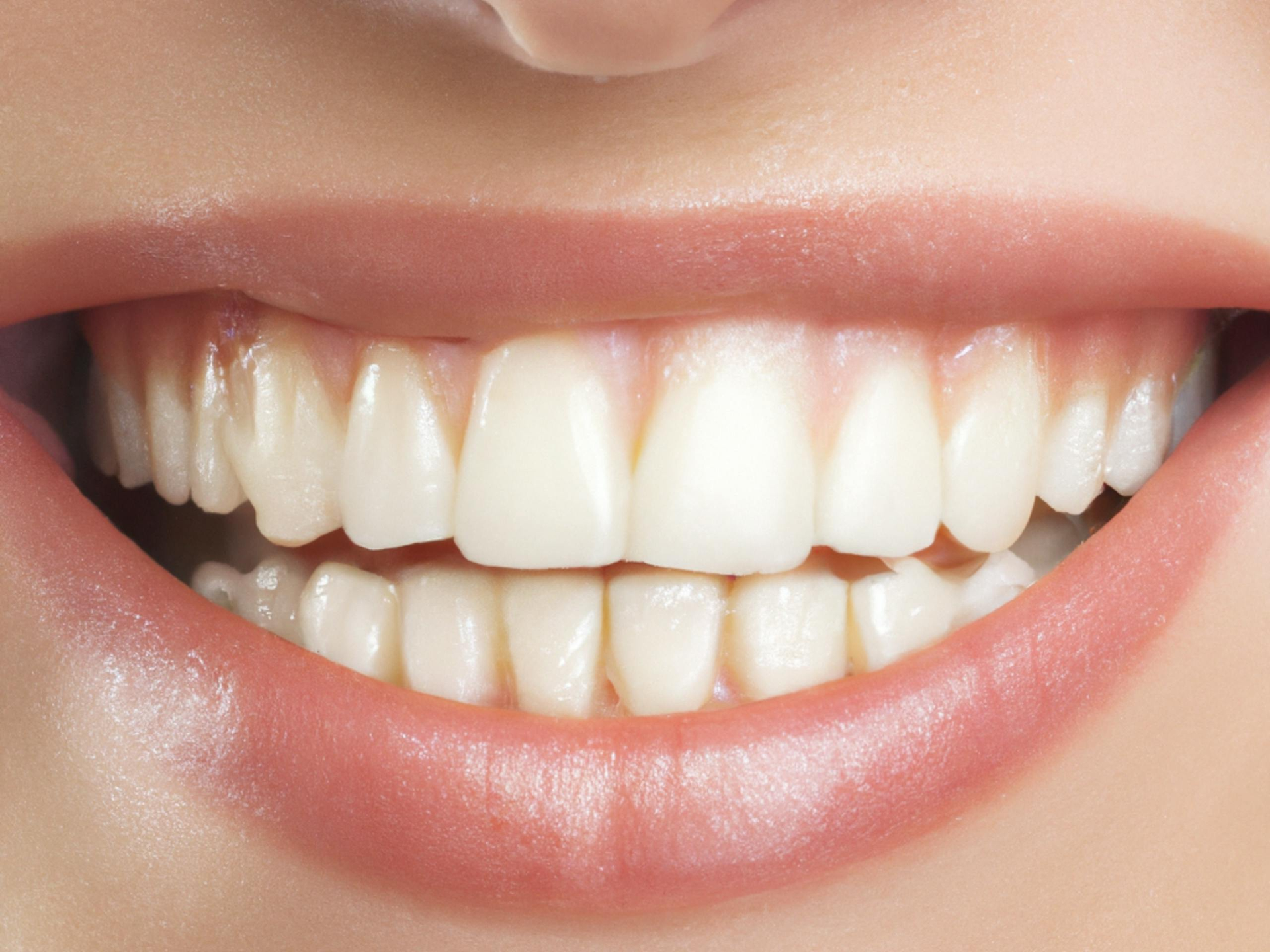 A close-up view of a smiling mouth showing clean, white, and well-aligned teeth.