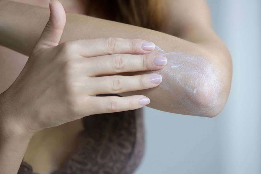 Persona che applica una crema su un gomito secco