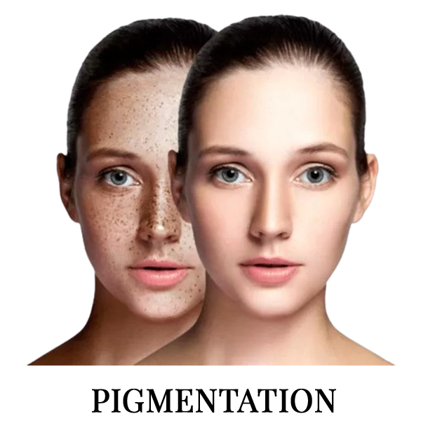 Two women faces side by side one with pigmented skin and other with clear and the word pigmentation under it