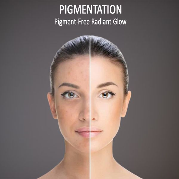 pigmentation treatment before after