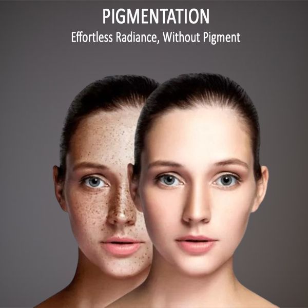 pigmentation treatment near me results