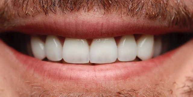 After treatment