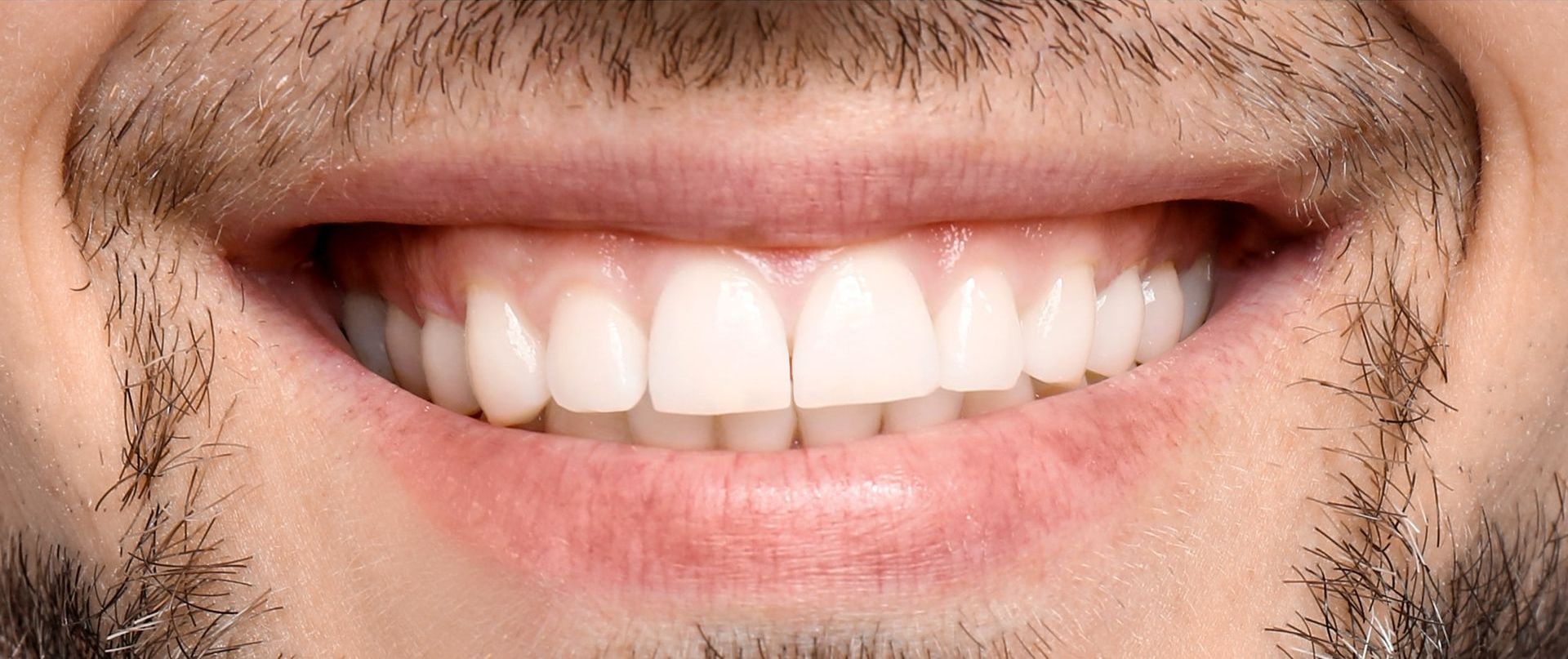 After treatment