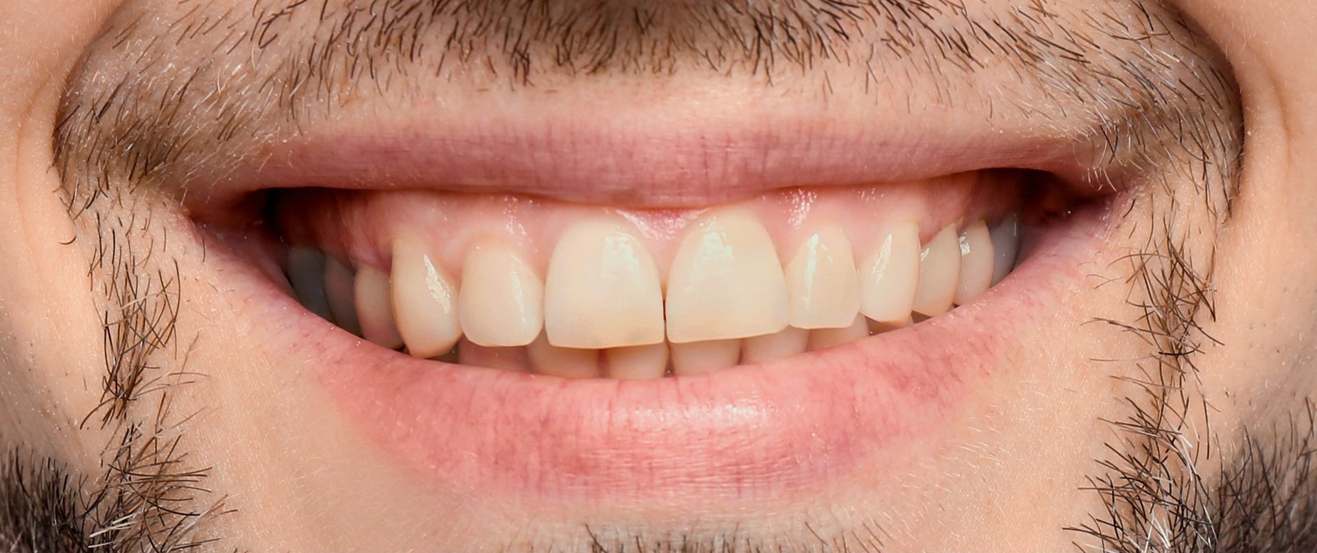 Before treatment