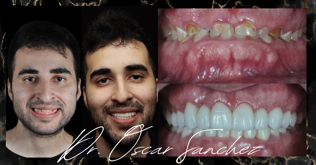 Dr. Oscar Sanchez before and after 6