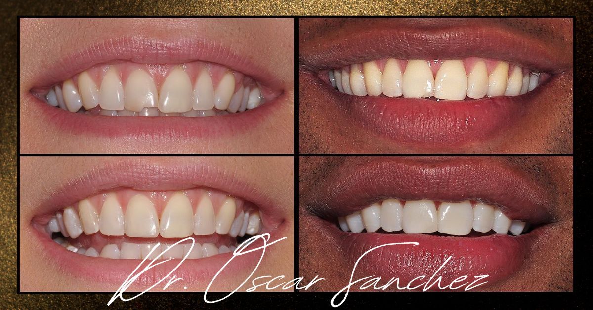 Dr. Oscar Sanchez before and after 1
