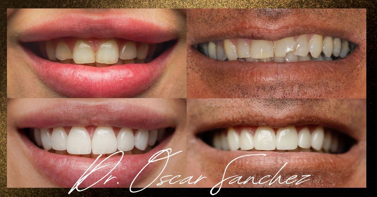 Dr. Oscar Sanchez before and after 1