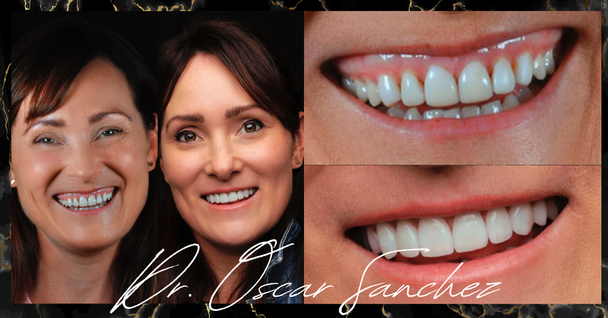 Dr. Oscar Sanchez before and after 5