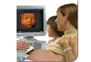 RADIOLOGIA INTEGRAL DE MEXICALI- Ultrasonido Acuson