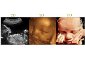 RADIOLOGIA INTEGRAL DE MEXICALI- Ultrasonido 3D y 4D