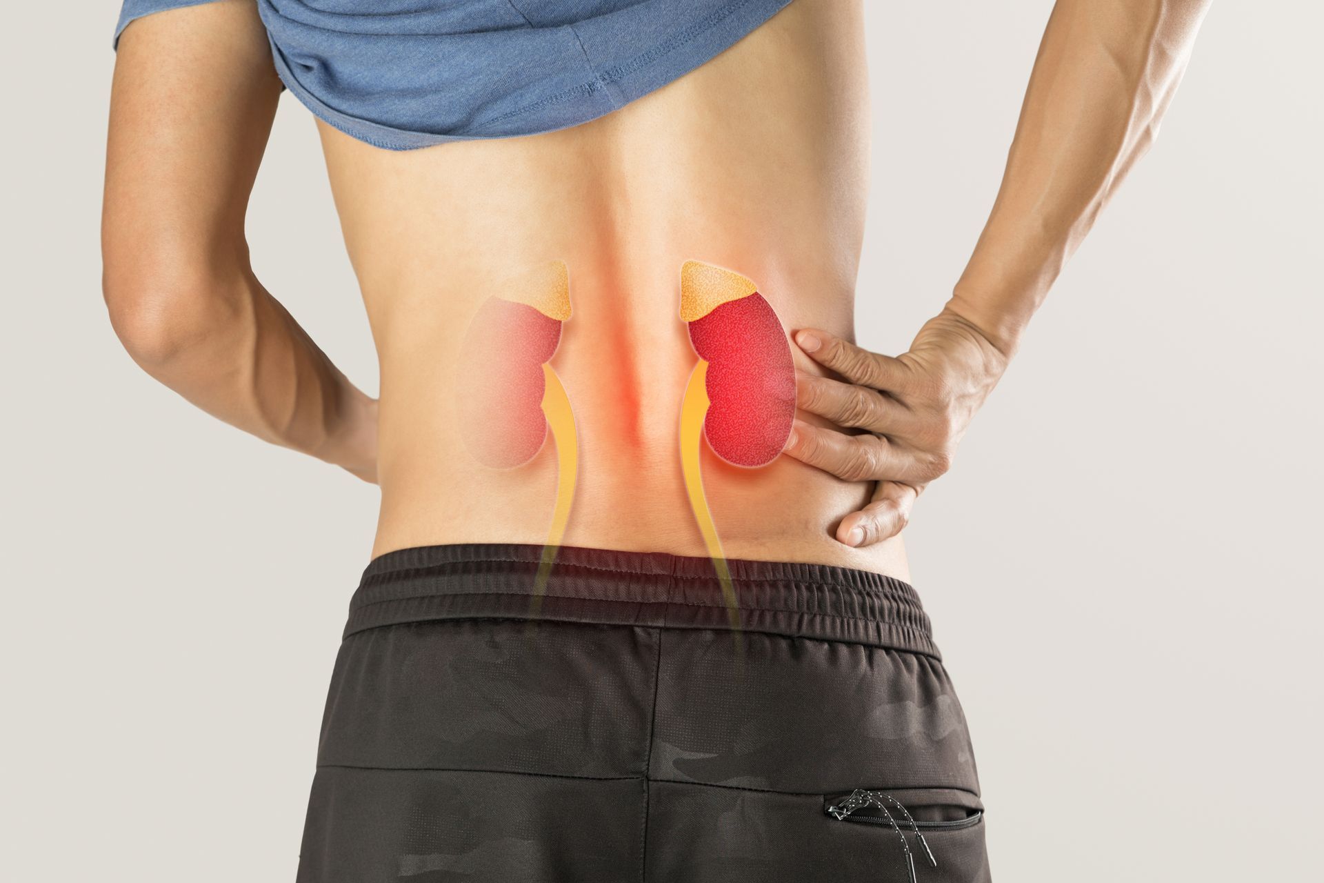 Person with highlighted kidneys, hand on back, possibly experiencing kidney pain.