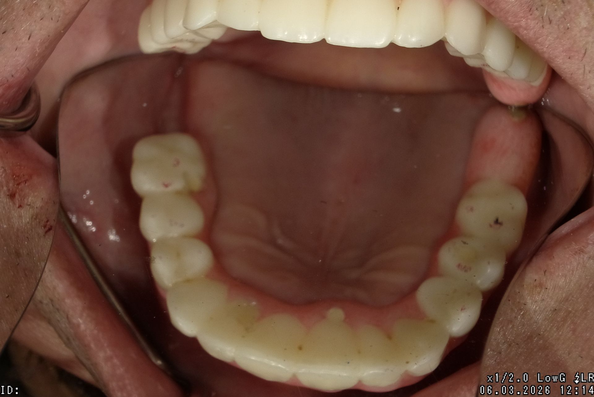 Open mouth showing the lower row of teeth and tongue