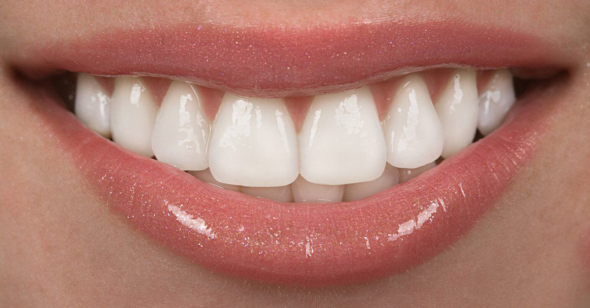 A close-up of a smiling mouth with straight, white, healthy-looking teeth.