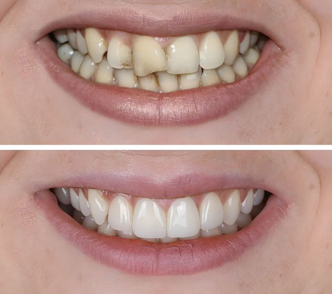 Smiling patient in a dental chair while a dentist works in the background