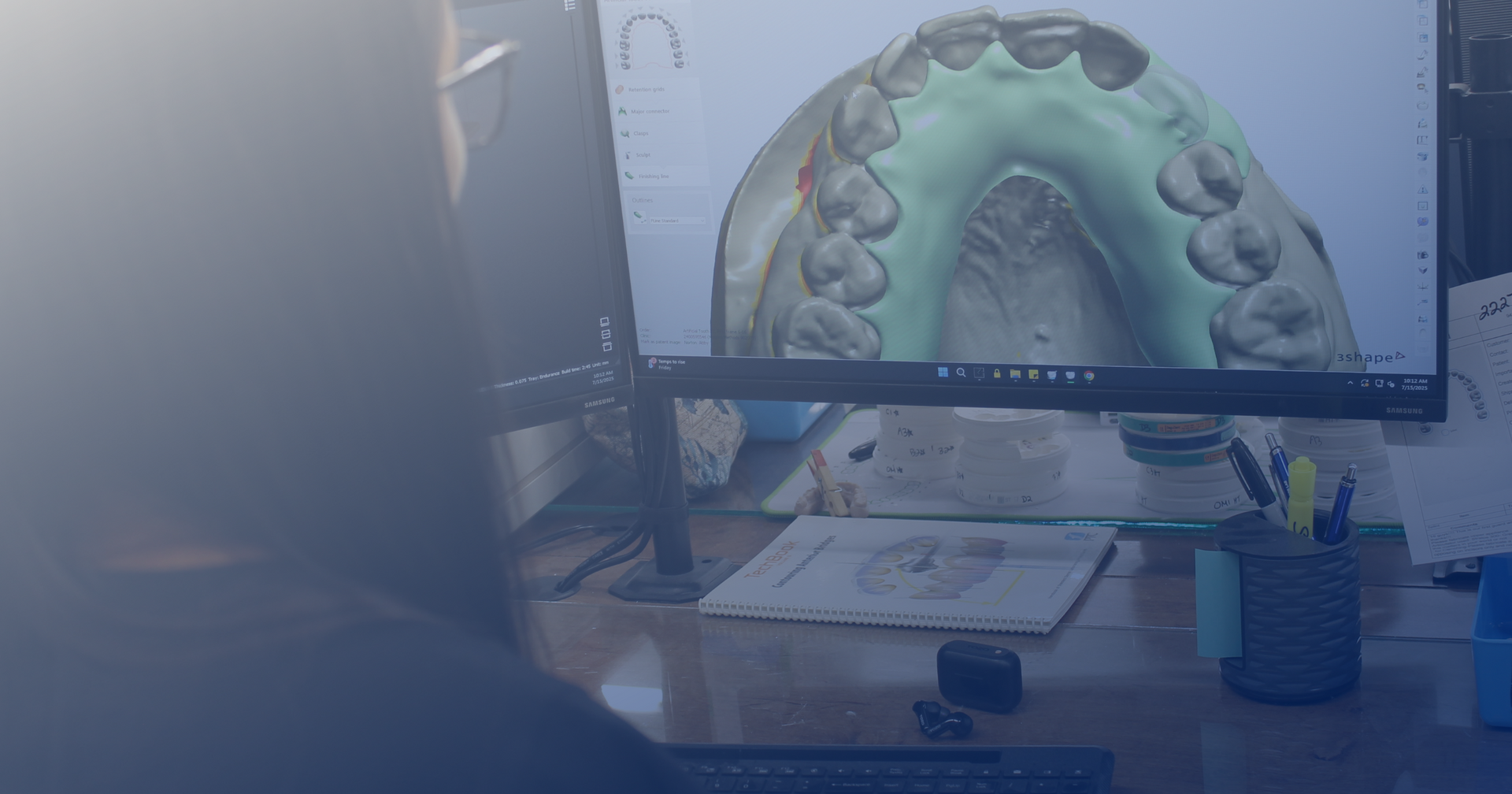 CAD/CAM technology with Modern Methods Dental Lab in Wichita, KS