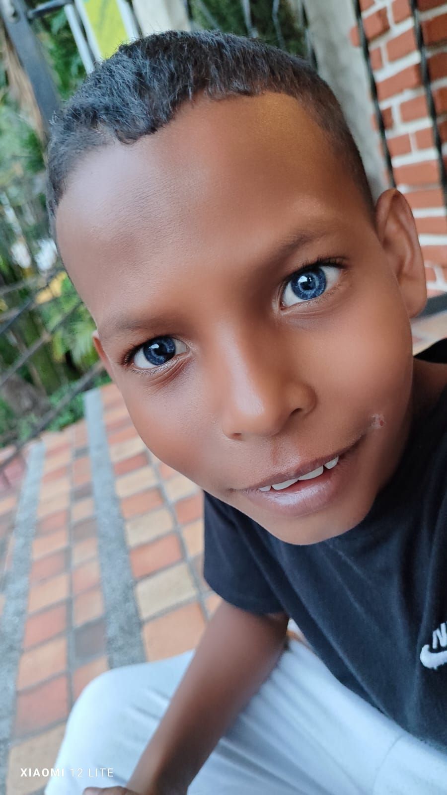 Un niño de brillantes ojos azules sonríe a la cámara, cabello corto y oscuro, sentado afuera.