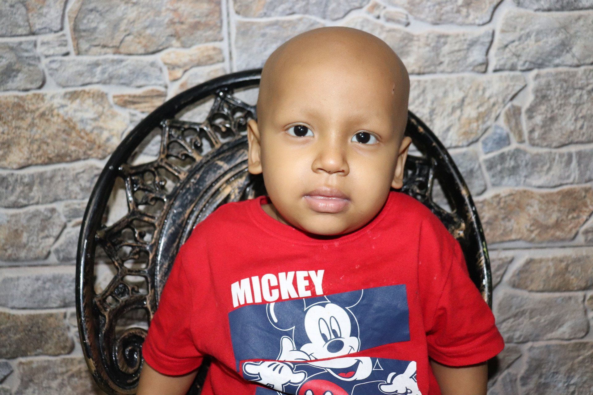 Niño con la cabeza rapada, vestido con una camiseta roja de Mickey Mouse