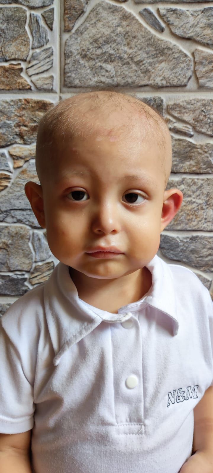 Un niño pequeño con la cabeza rapada y una expresión seria que viste una camisa de cuello blanco frente a un muro de piedra.