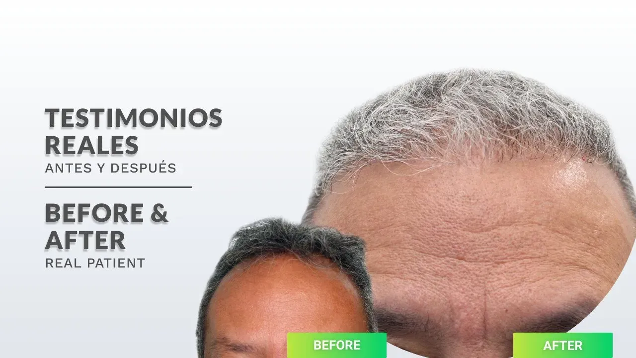 a before and after photo of a man 's head