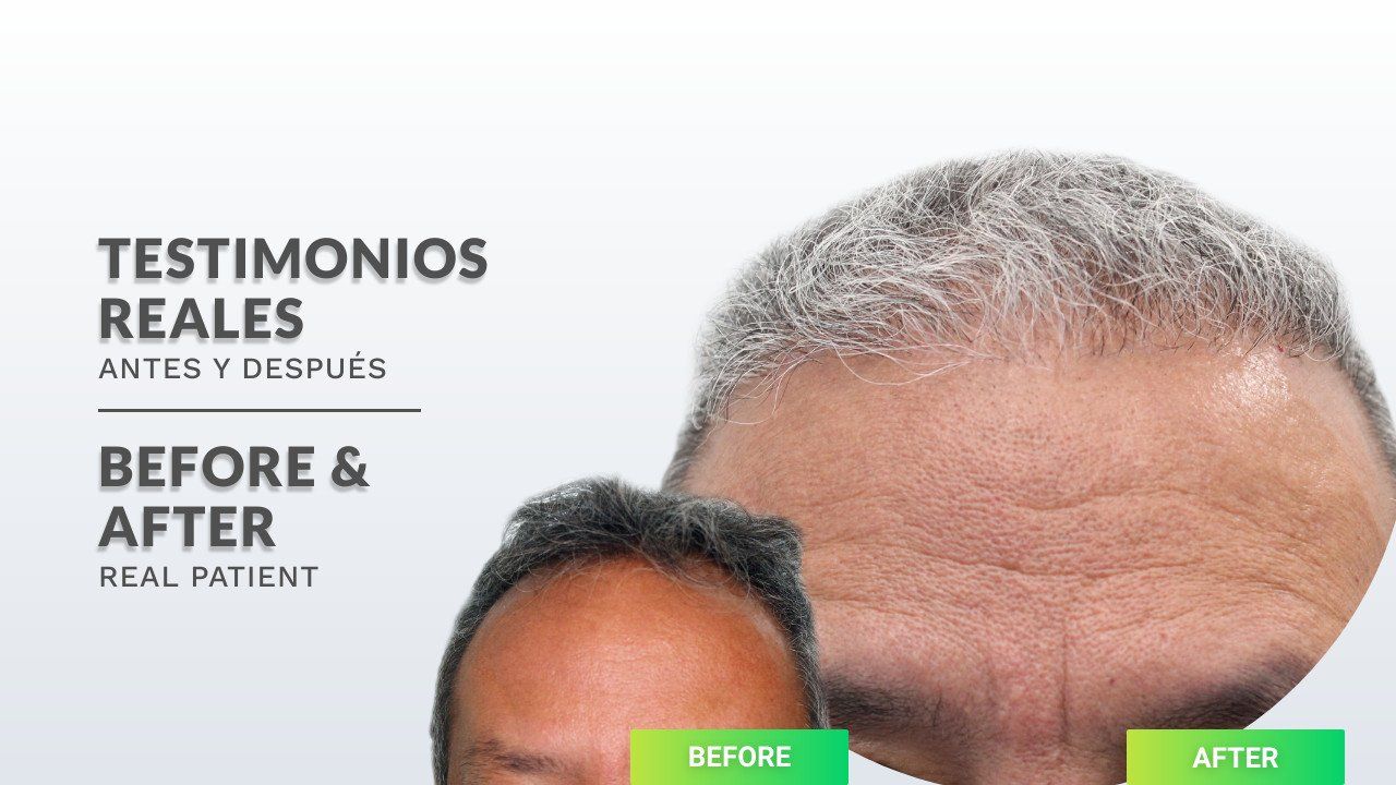 una foto de antes y después de la cabeza de un hombre