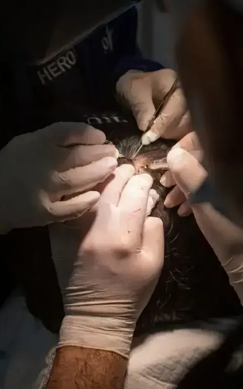 a person wearing gloves is operating on a cat