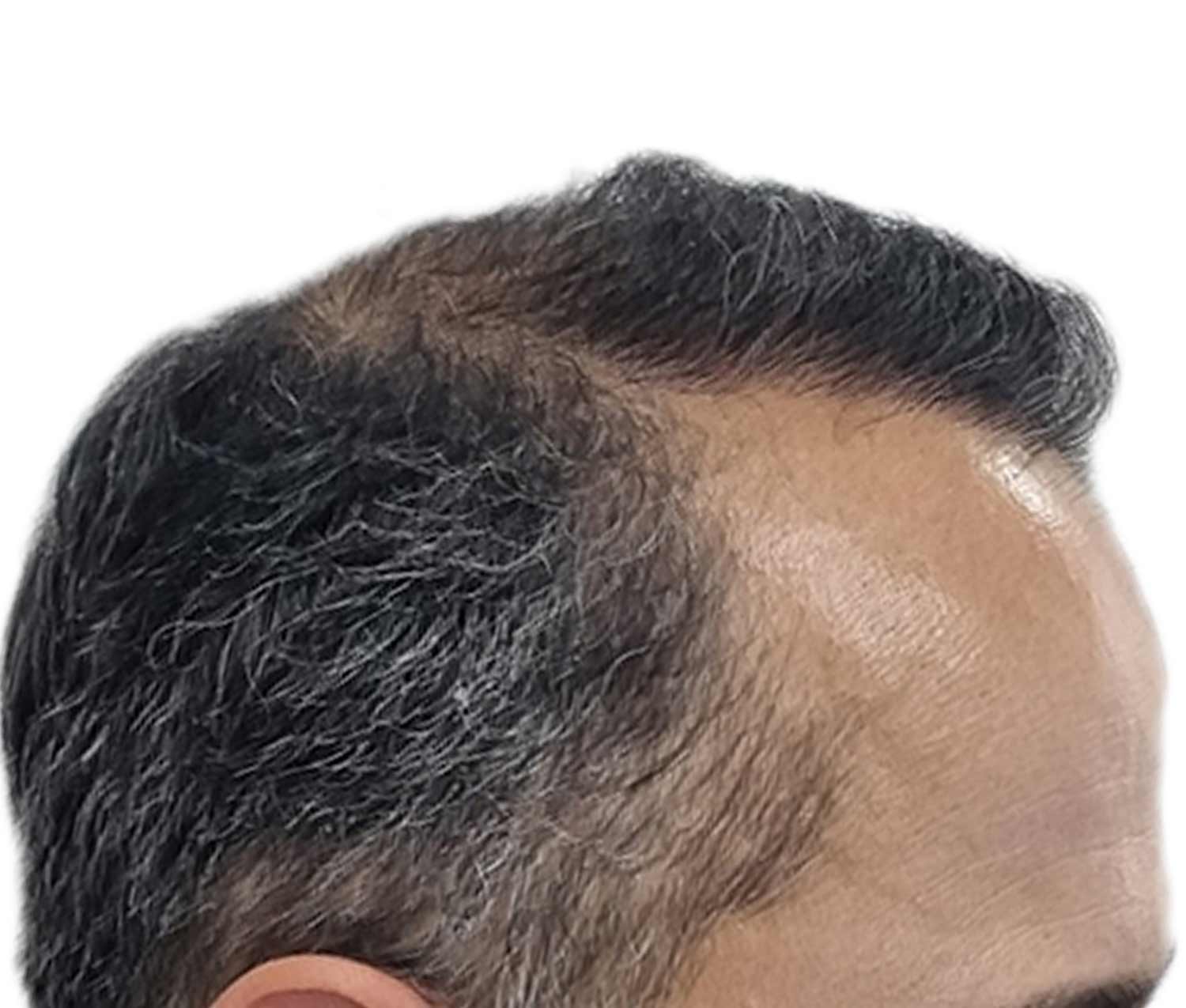 a close up of a man 's head with gray hair .
