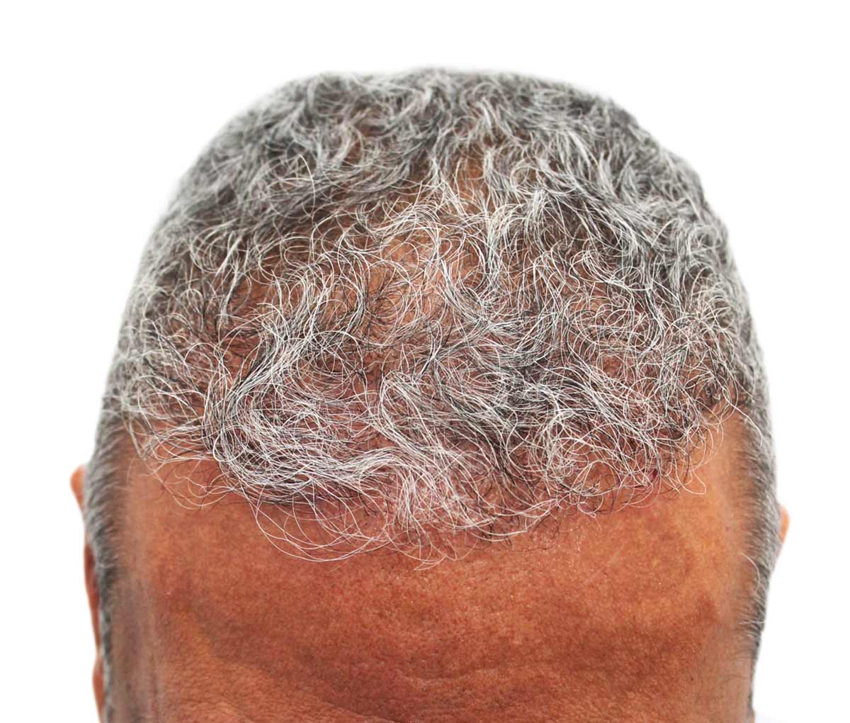 a close up of a man 's head with gray hair .