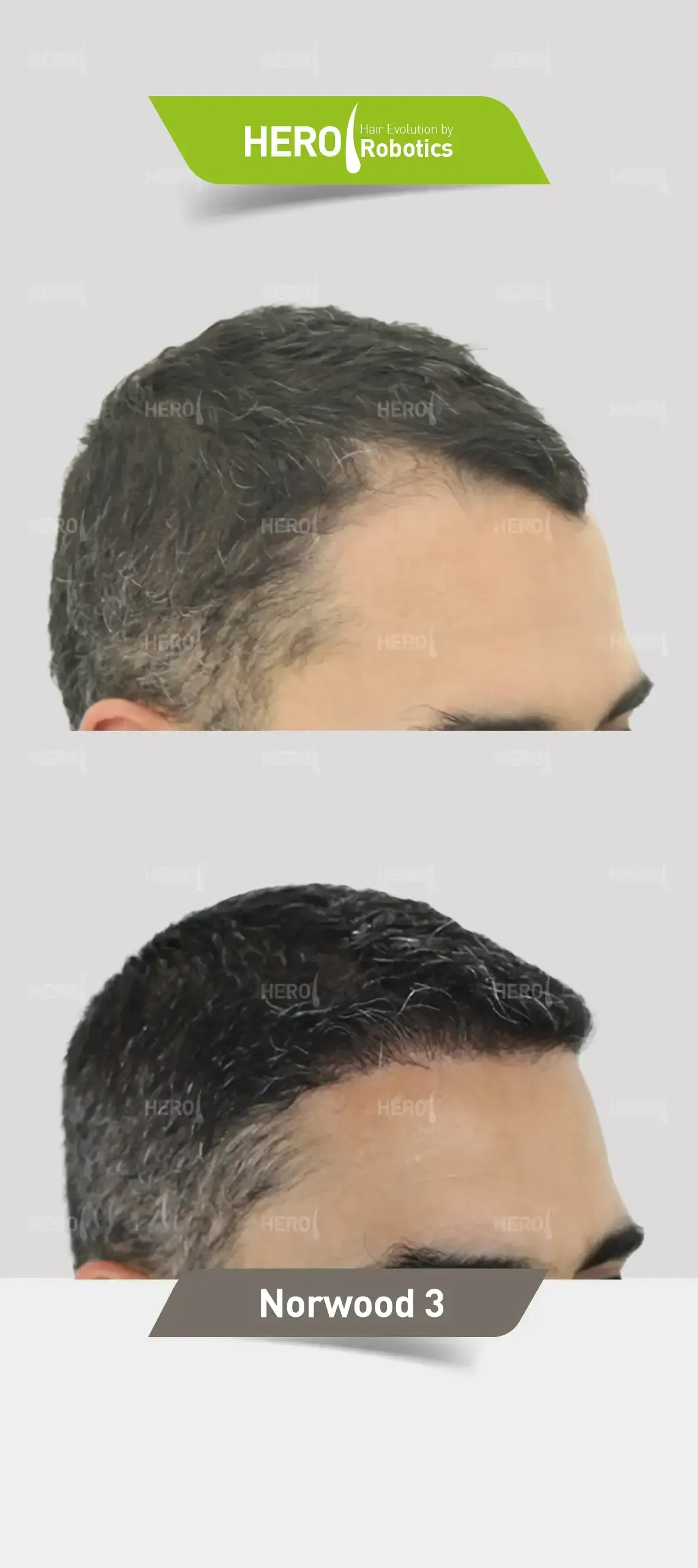 A before and after picture of a man 's hair