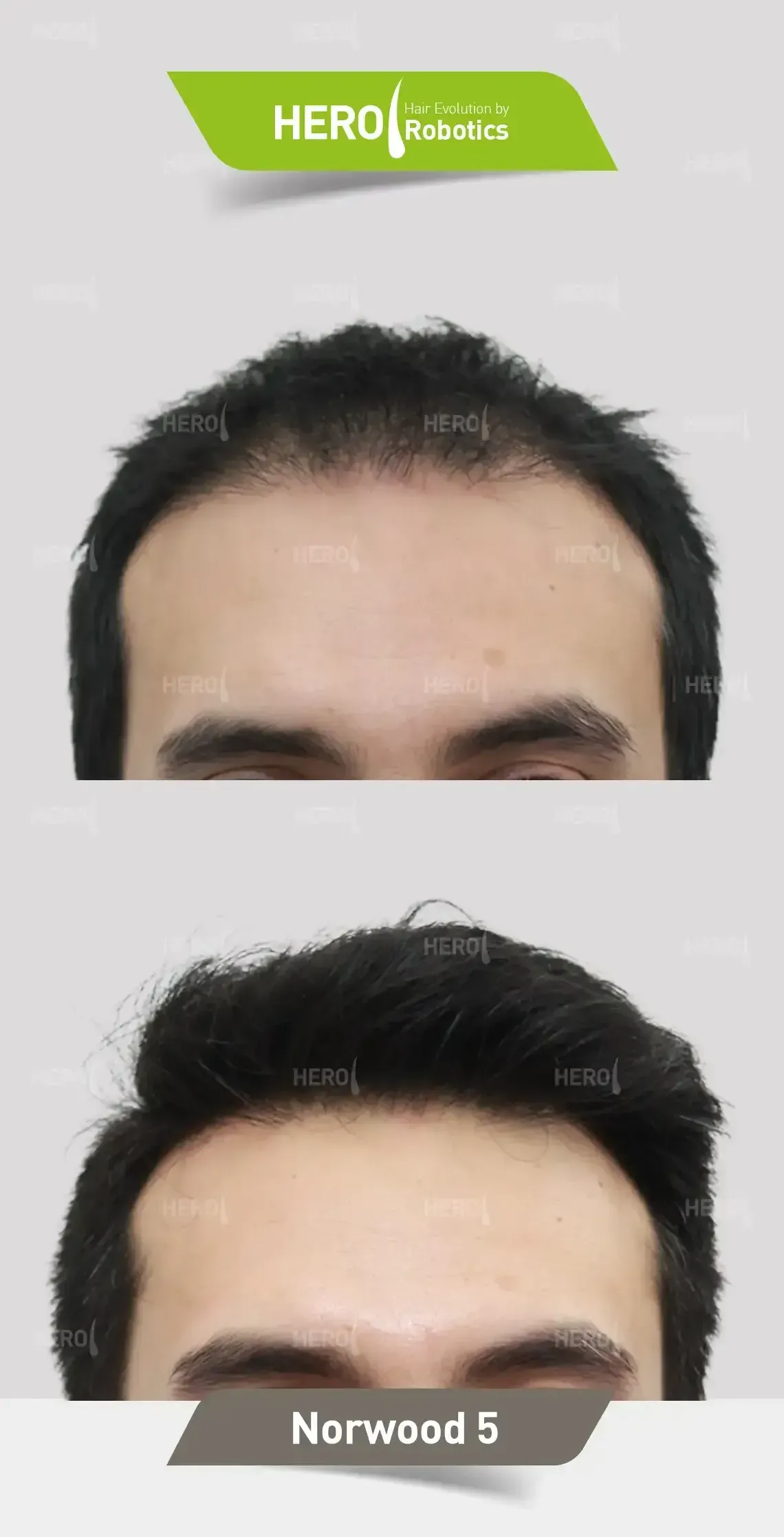 A before and after picture of a man 's hair