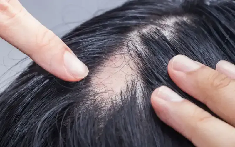 A person is touching a woman 's hair with their fingers.