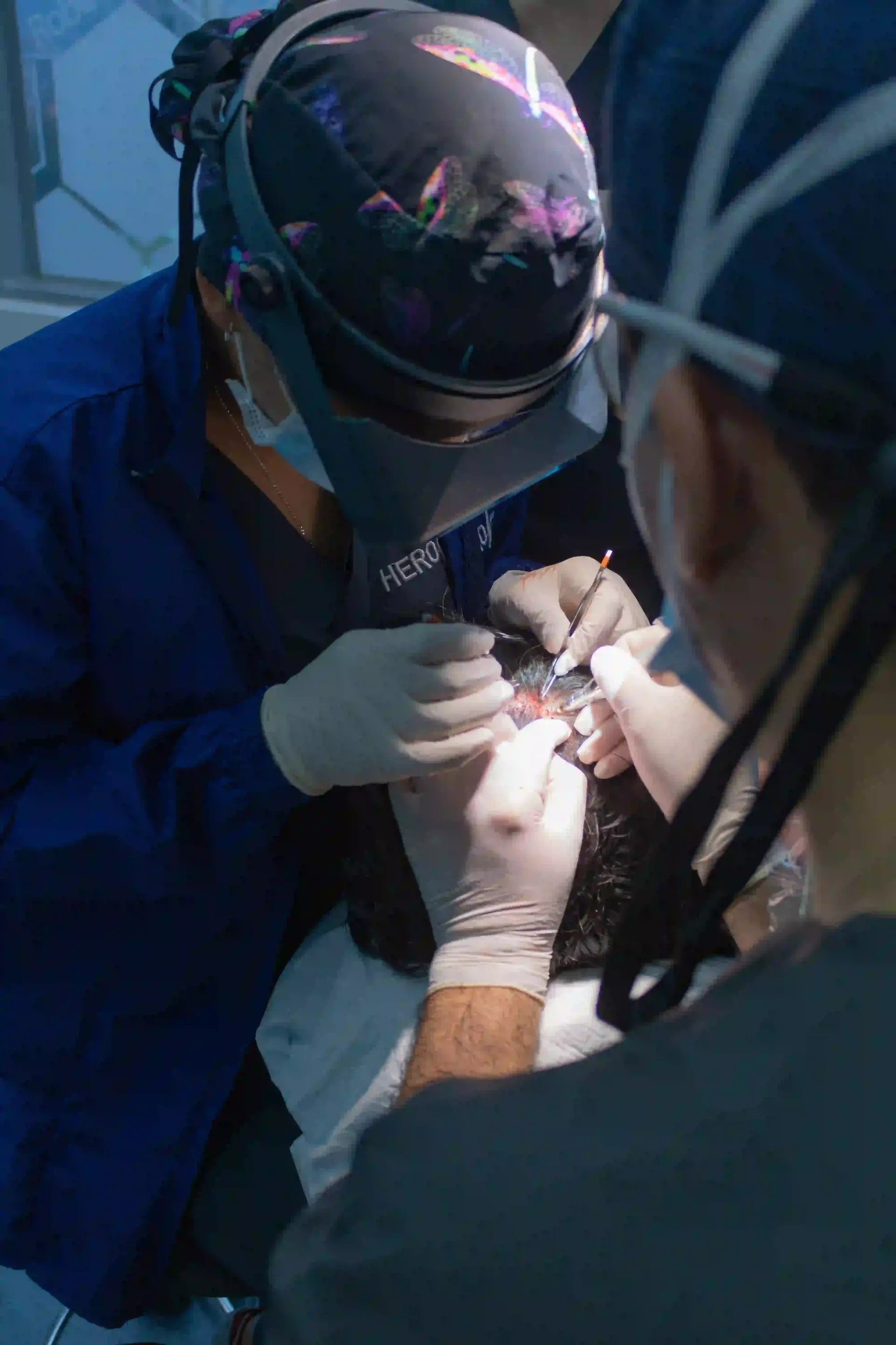 HERO Hair Transplant Surgeons 