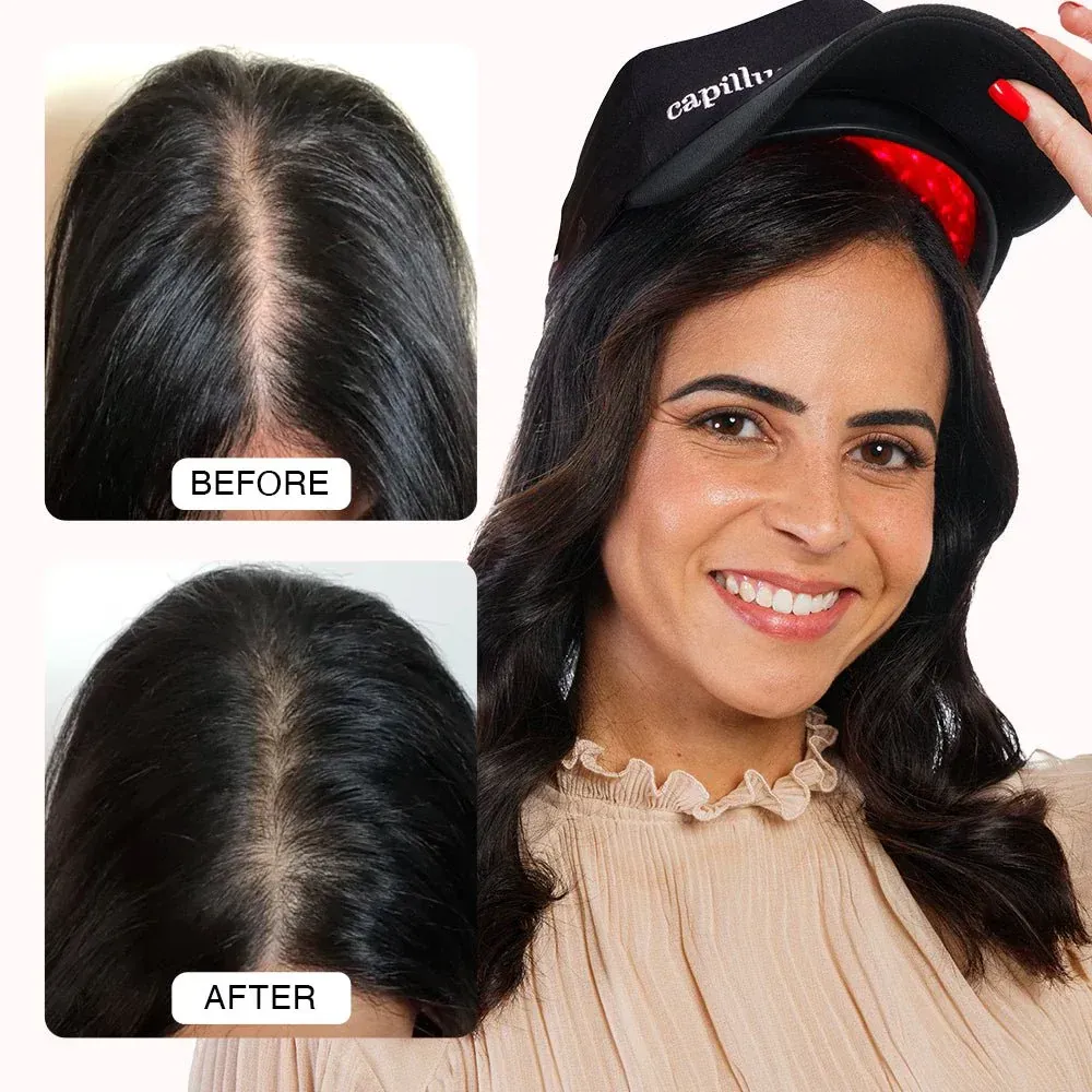 A before and after picture of a man 's hair