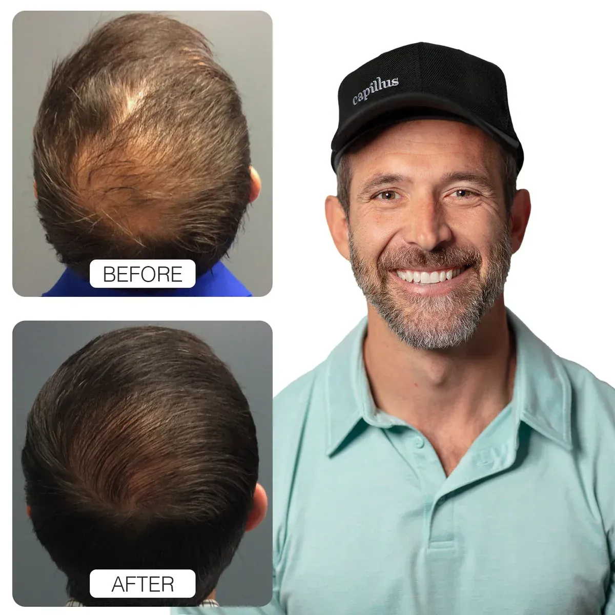 A before and after picture of a man 's hair