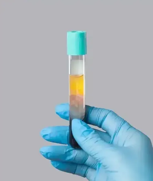 A person wearing blue gloves is holding a test tube with liquid in it.