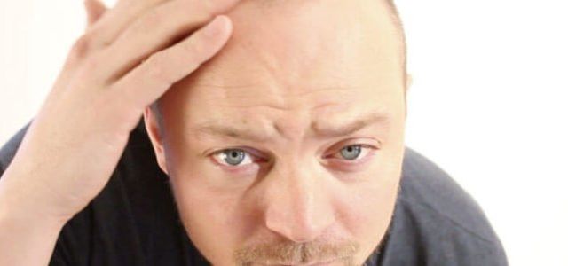 Man with significant hair loss looking at himself in the mirror