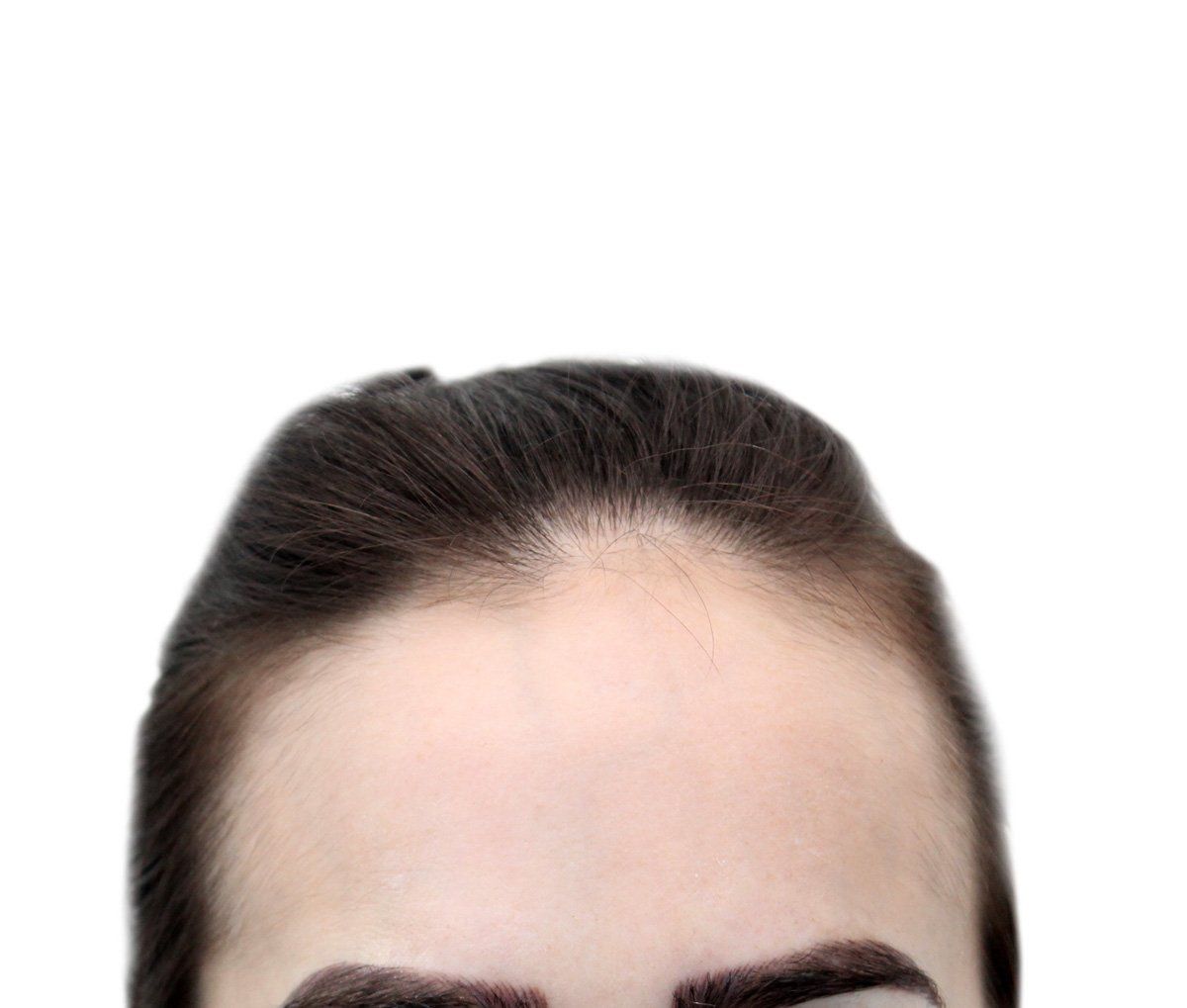 Forehead with dark hair pulled back, eyebrows visible, against a white background.