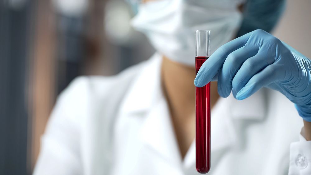 Un tubo con una muestra de sangre