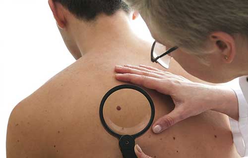 Diagnosing the skin — Aurora, CO — The Sun Bus