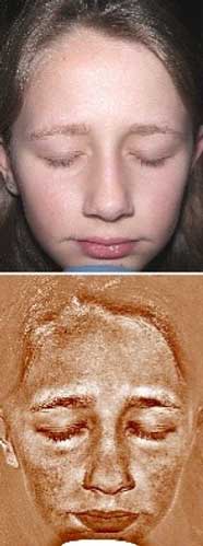 Facial imager result — Aurora, CO — The Sun Bus Facial imager result — Aurora, CO — The Sun Bus