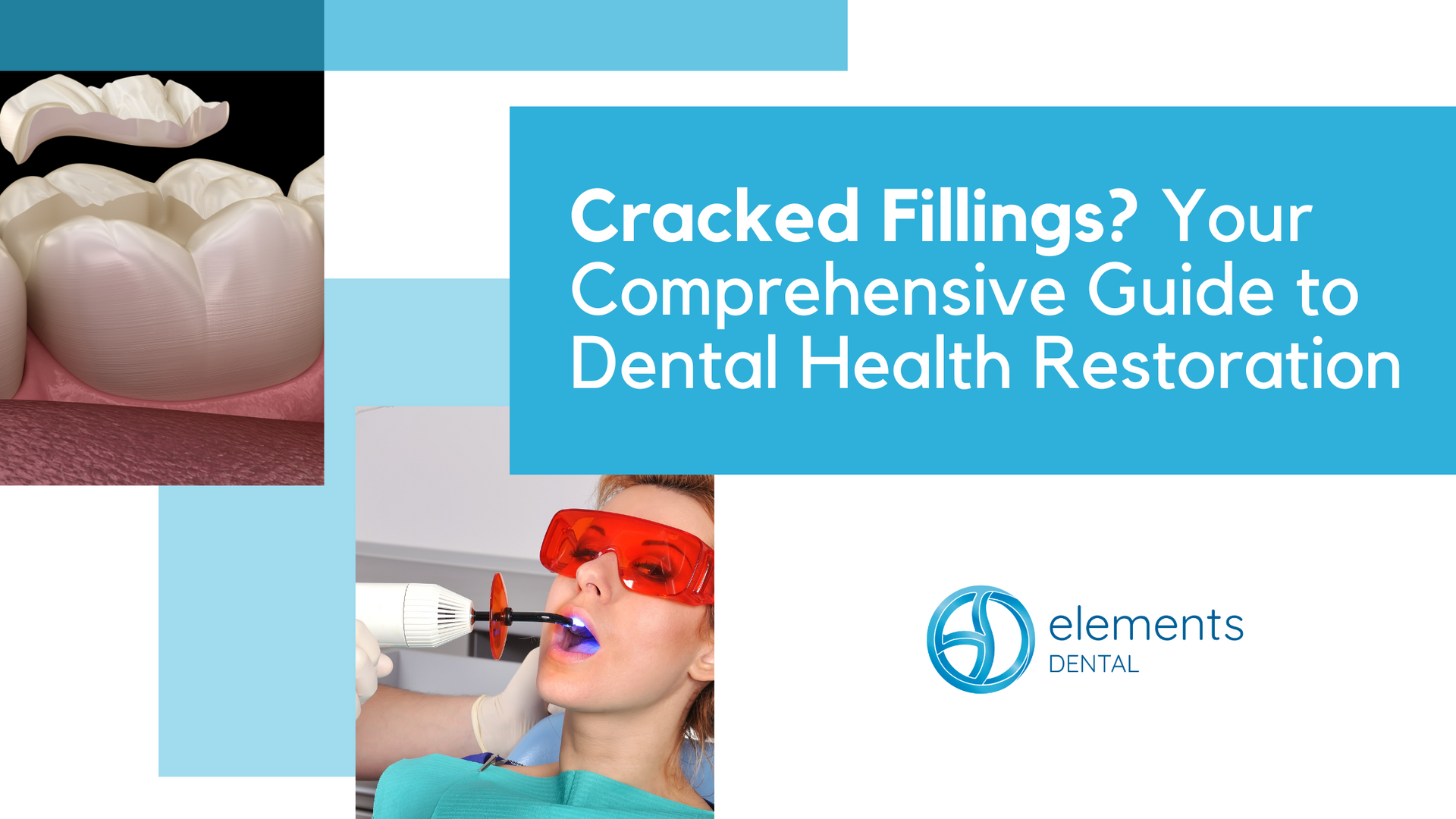 Cracked fillings ? your comprehensive guide to dental health restoration
