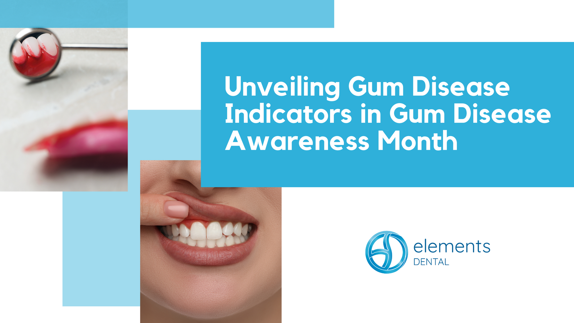 A poster for unveiling gum disease indicators in gum disease awareness month