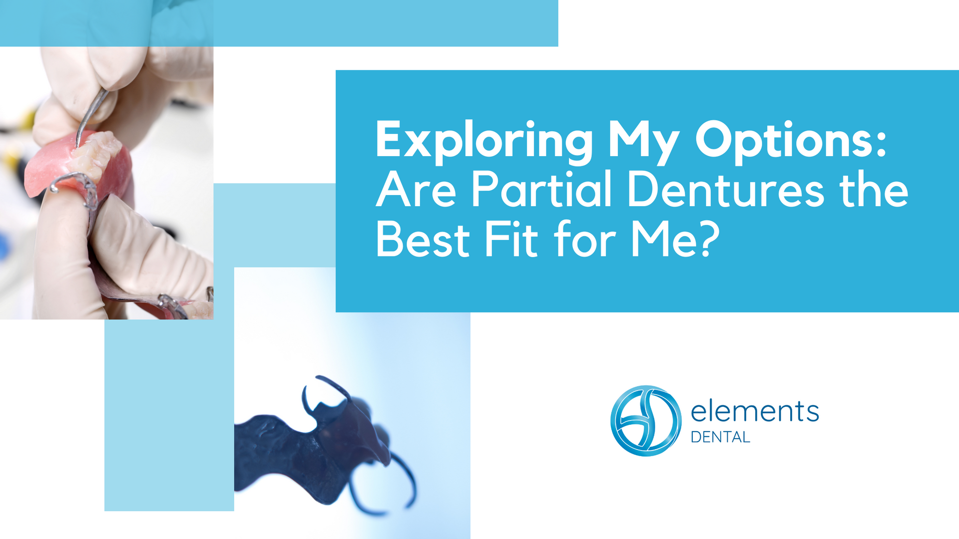 A poster that says exploring my options are partial dentures the best fit for me