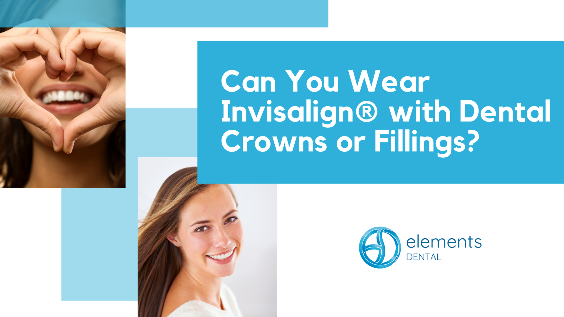 Ad with smiling people and text: “Can You Wear Invisalign® with Dental Crowns or Fillings?”