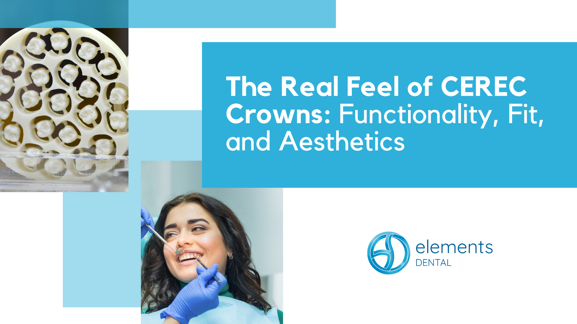 The real feel of cerec crowns : functionality , fit , and aesthetics