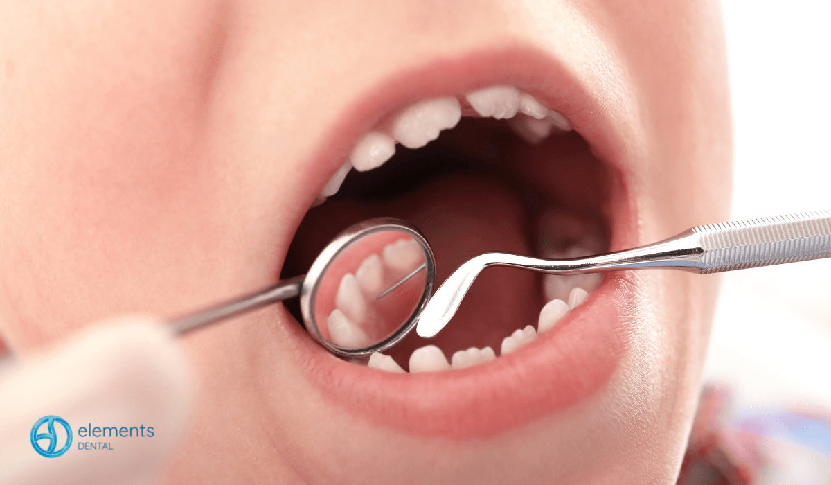 Dental mirror and tool examining a child’s open mouth and teeth