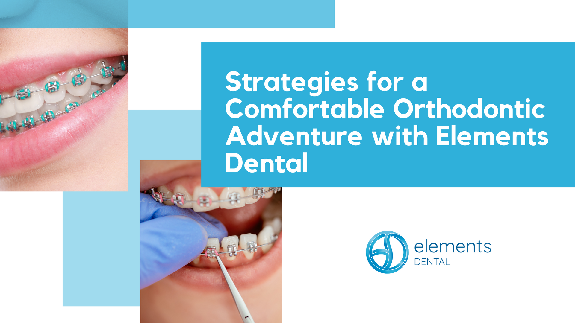 Strategies for a comfortable orthodontic adventure with elements dental