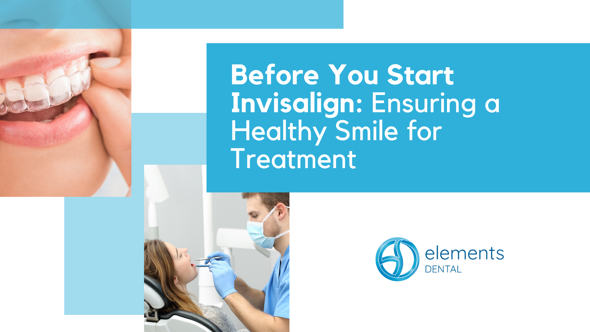 Before you start invisalign : ensuring a healthy smile for treatment