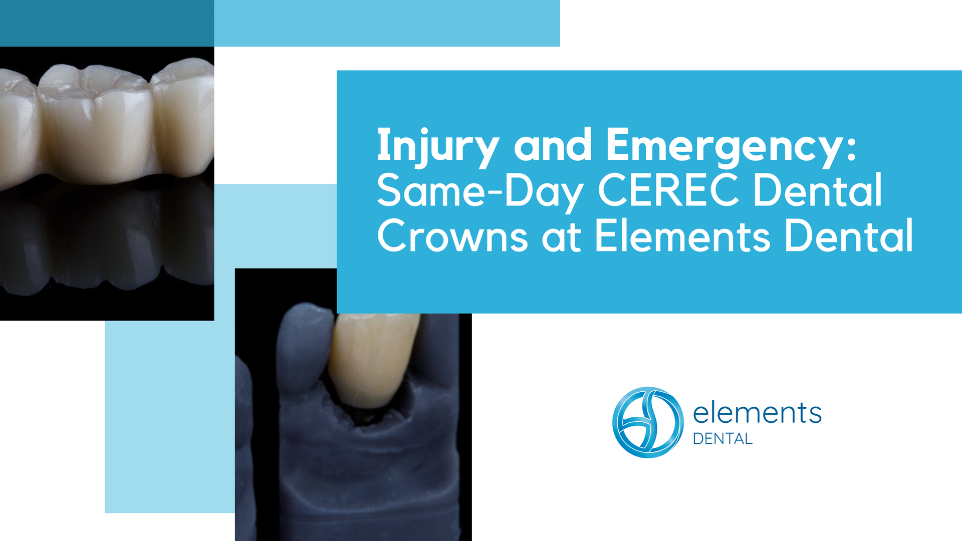 A poster with the words injury and emergency same day cerec dental crowns at elements dental